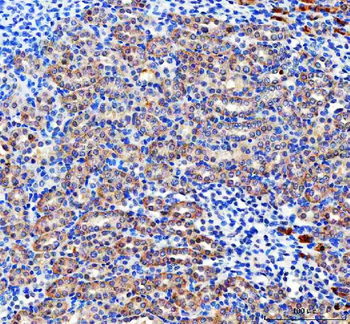 Pyruvate Carboxylase/PC Rabbit Polyclonal Antibody
