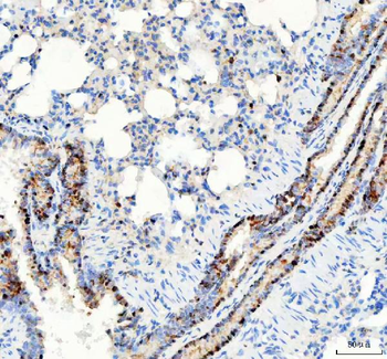 PARP3 Rabbit Polyclonal Antibody