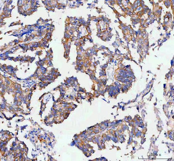RAB3IP Rabbit Polyclonal Antibody