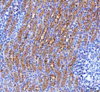 RAB3IP Rabbit Polyclonal Antibody