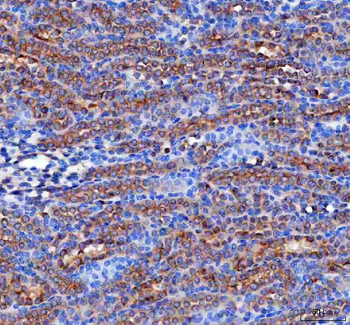 RAB3IP Rabbit Polyclonal Antibody