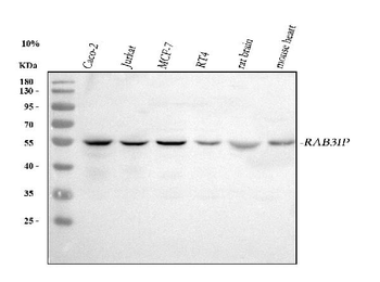 RAB3IP Rabbit Polyclonal Antibody