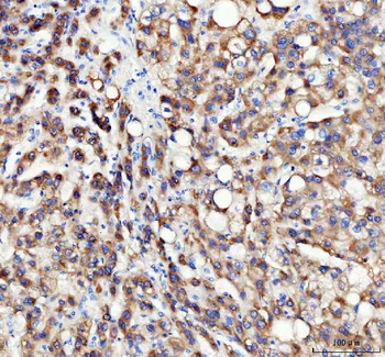 INSIG1 Rabbit Polyclonal Antibody