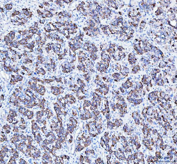 ATG7 Antibody