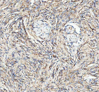 ATG7 Antibody