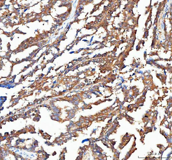 OTUB1 Rabbit Polyclonal Antibody