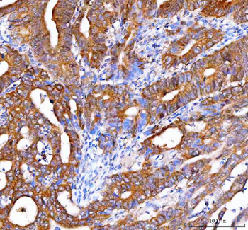 OTUB1 Rabbit Polyclonal Antibody