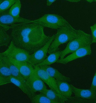 PAWR Rabbit Polyclonal Antibody