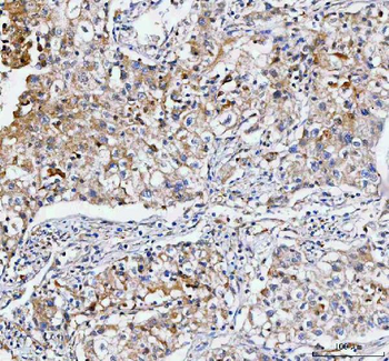 IFT74 Rabbit Polyclonal Antibody