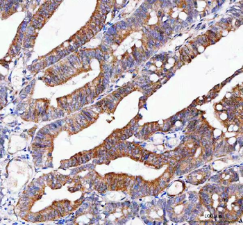 IFT74 Rabbit Polyclonal Antibody