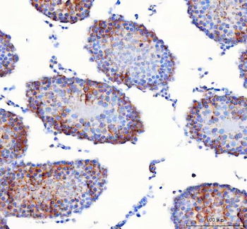 IFT74 Rabbit Polyclonal Antibody