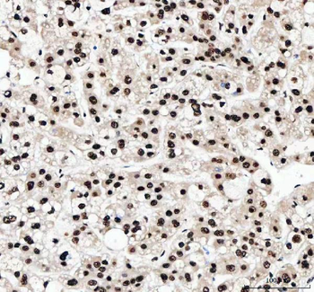 NF45/ILF2 Antibody
