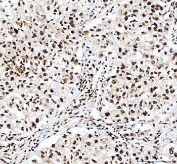 NF45/ILF2 Antibody