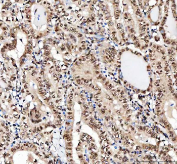 NF45/ILF2 Antibody
