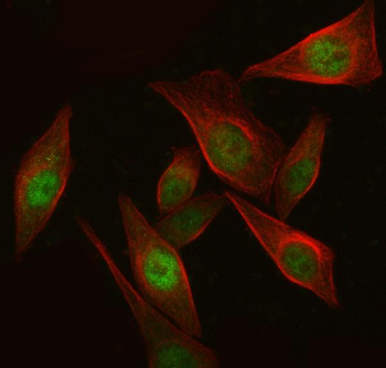 IKZF3 Rabbit Polyclonal Antibody