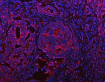 IFT52 Rabbit Polyclonal Antibody