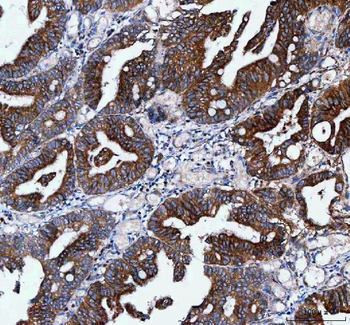 IFT52 Rabbit Polyclonal Antibody