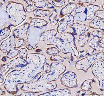 IFT52 Rabbit Polyclonal Antibody