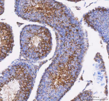 IFT52 Rabbit Polyclonal Antibody