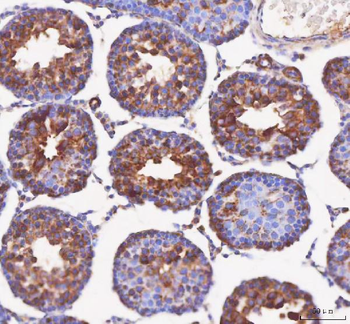 IFT52 Rabbit Polyclonal Antibody