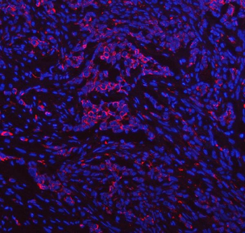 IDUA Rabbit Polyclonal Antibody