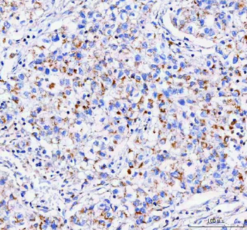 IDUA Rabbit Polyclonal Antibody