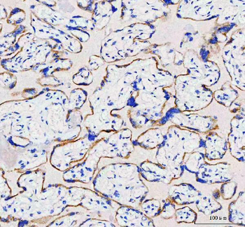 IDUA Rabbit Polyclonal Antibody
