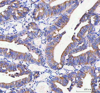 IDUA Rabbit Polyclonal Antibody