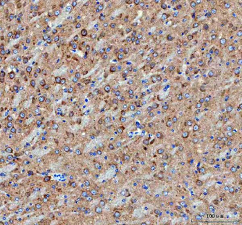 IDUA Rabbit Polyclonal Antibody