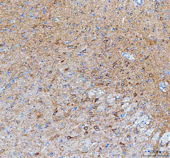 IDUA Rabbit Polyclonal Antibody