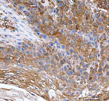 IDI1 Rabbit Polyclonal Antibody