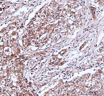 IDI1 Rabbit Polyclonal Antibody