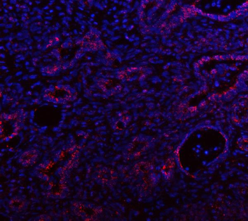 IDH3A Rabbit Polyclonal Antibody