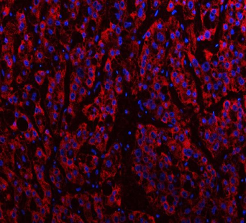IDH3A Rabbit Polyclonal Antibody