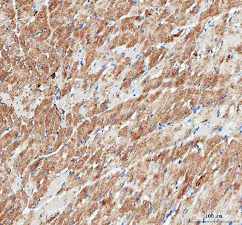 IDH3A Rabbit Polyclonal Antibody