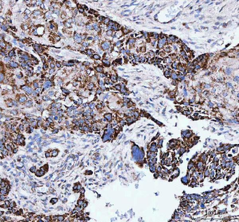 IARS2 Rabbit Polyclonal Antibody