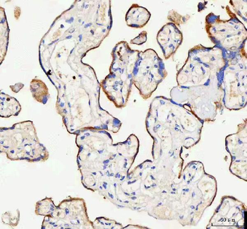 IARS2 Rabbit Polyclonal Antibody