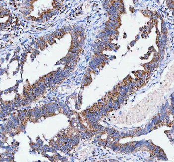 IARS2 Rabbit Polyclonal Antibody