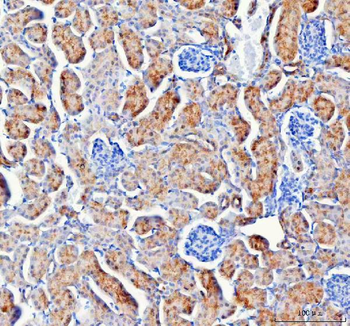 IARS2 Rabbit Polyclonal Antibody