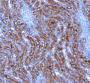IARS2 Rabbit Polyclonal Antibody