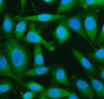 LYPLA2 Rabbit Polyclonal Antibody