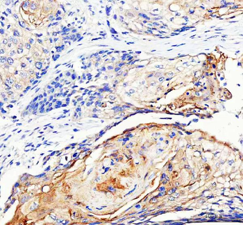 LYPLA2 Rabbit Polyclonal Antibody