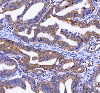 LYPLA2 Rabbit Polyclonal Antibody