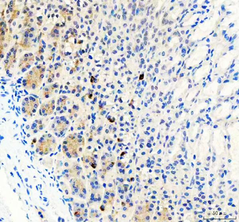 LYPLA2 Rabbit Polyclonal Antibody