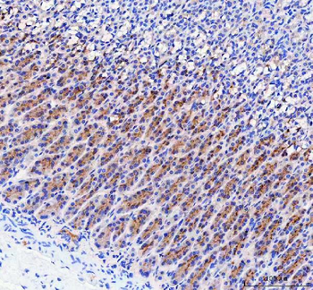 LYPLA2 Rabbit Polyclonal Antibody