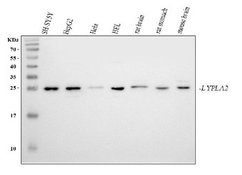 LYPLA2 Rabbit Polyclonal Antibody