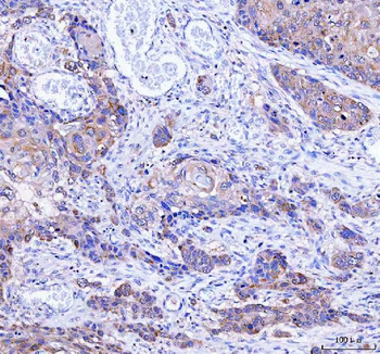 LYPLA1 Rabbit Polyclonal Antibody