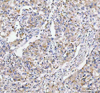 LYPLA1 Rabbit Polyclonal Antibody