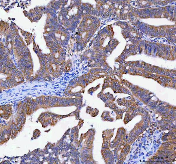 LYPLA1 Rabbit Polyclonal Antibody