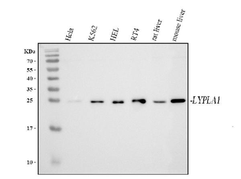 LYPLA1 Rabbit Polyclonal Antibody